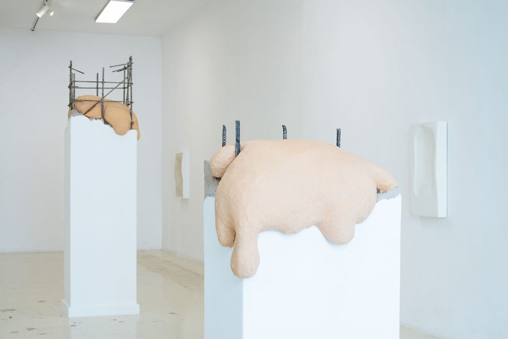 EMMA-MARTING_EM_CONTRAFORMAS_C_2